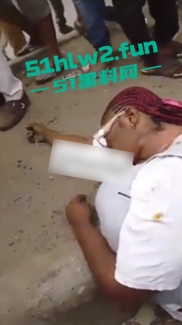 【血腥恐怖】尼日利亚重大车祸一妇女坐在货车前休息，由于视线盲区司机并未发现 将其碾压成两截。-1