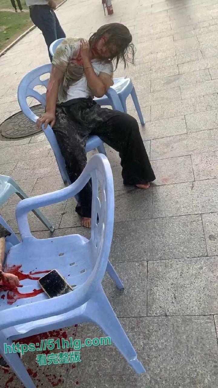 疯狂纵火撞学校!【福建漳州云霄县】司机骇人行径震惊众人,多名学生受伤 现场一片血肉横飞惨象-7