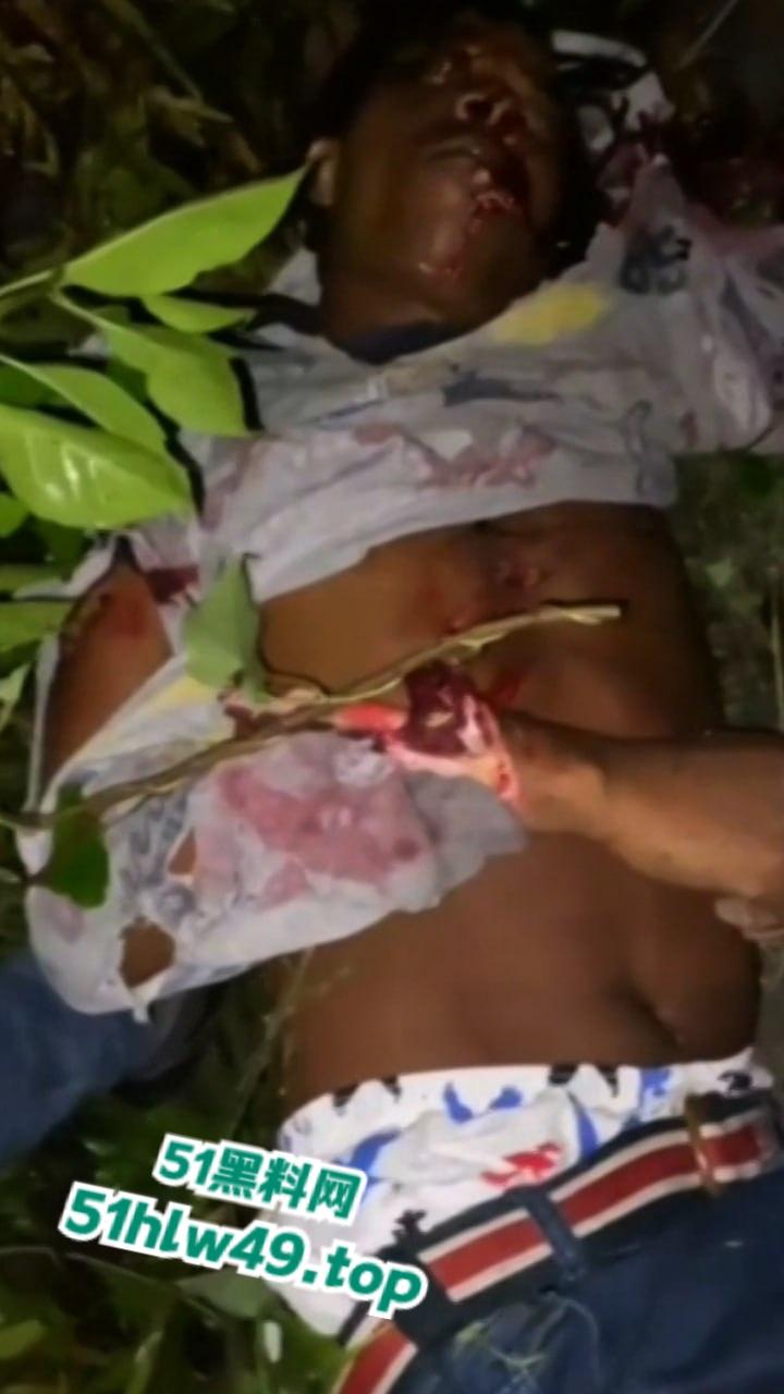 血腥恐怖,非洲南部车祸乡间公路步行,司机未看清路况当场将撞飞路人,手脚全断死相极其残忍。-6