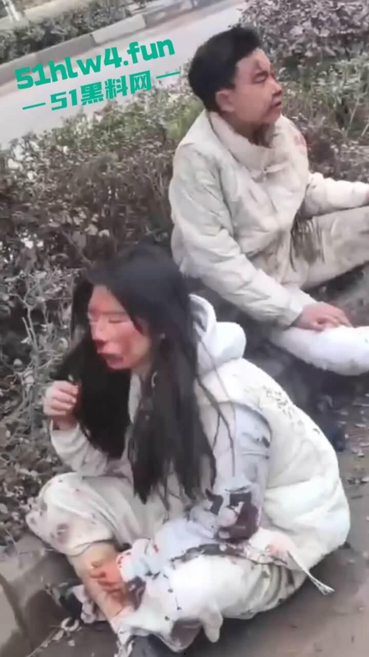 内江资中奇葩车祸五菱宏光加速超车,竟然失控出车祸俩人都变成熊猫脸,看着太搞笑了。-1