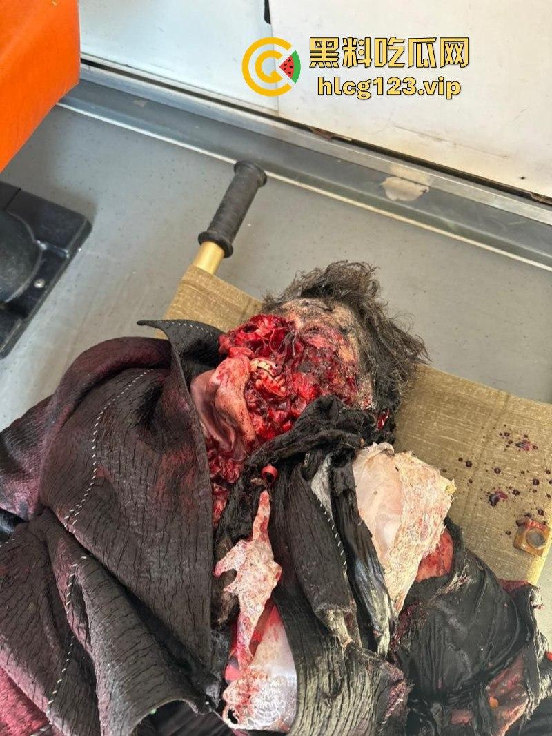 坐等看戏！伊朗对以色列的导弹袭击已结束 美准备好对抗伊朗？内含血腥无码画面 慎入！！！-4