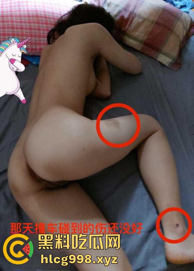 26岁姑娘被撞腿、被日逼！车主套路不断不懈努力搭讪成功，小仙女从拒绝到沦陷的全过程！-9