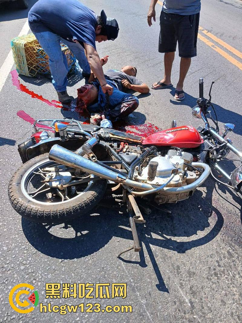 血腥恐怖交通事故，圣克鲁斯男骑手出车祸，左腿被当场撞断，现场视频流出胆小者勿入！-1