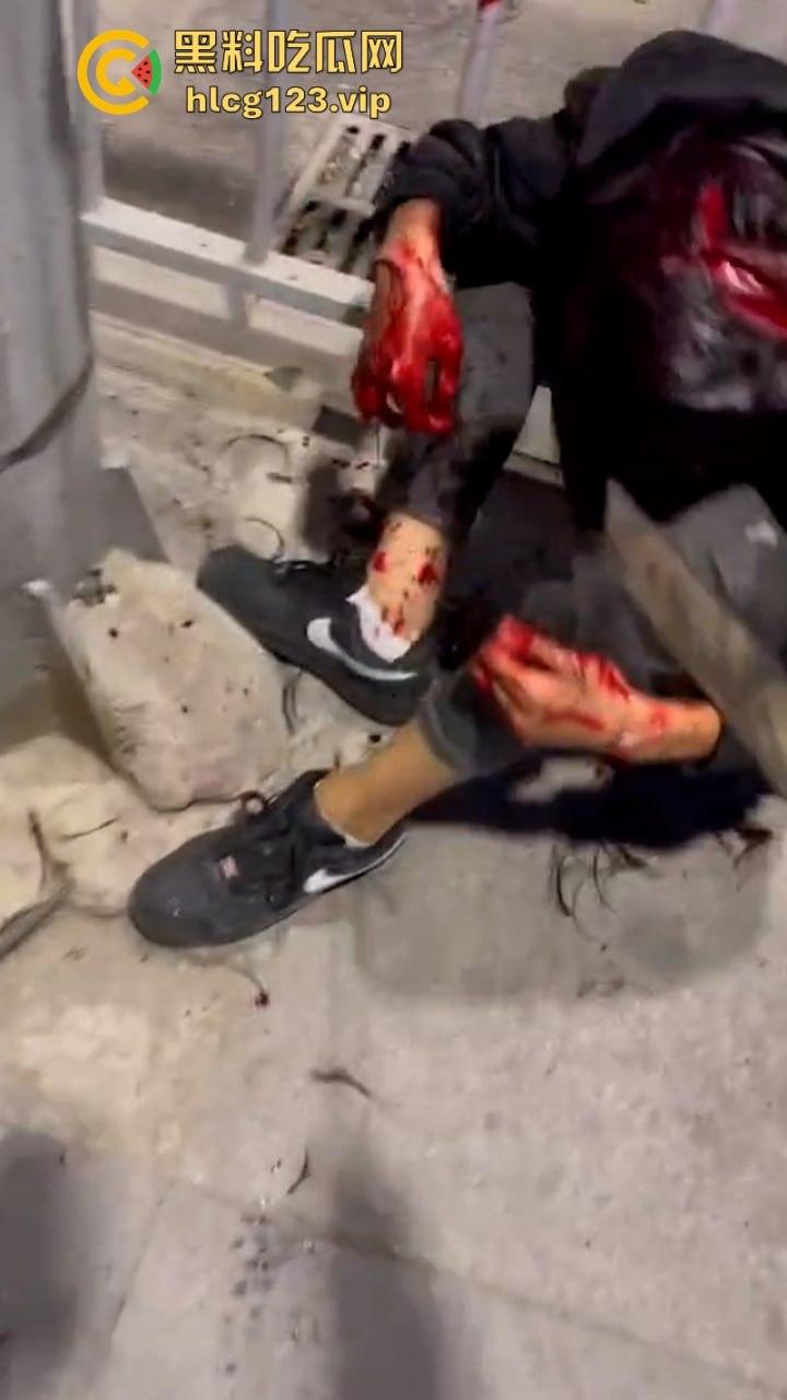 广东街头多人持刀互砍！血洒街头惨不忍睹 现场视频曝光砍头细节 太吓人了-10
