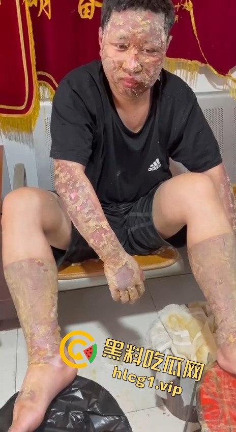 内蒙古呼和浩特惊魂一刻！02年精神小伙偷骑V4机车撞上右转SUV，摩托车当场燃烧！-8