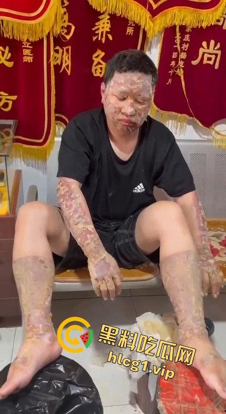 内蒙古呼和浩特惊魂一刻！02年精神小伙偷骑V4机车撞上右转SUV，摩托车当场燃烧！-12