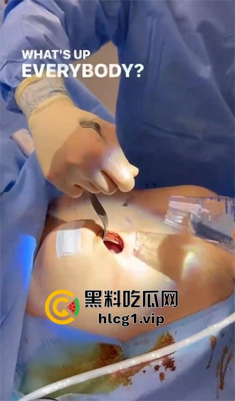 7W就能让你机场变巨乳！抖音上那些36D大胸妹子，原来都是这么来的！-6