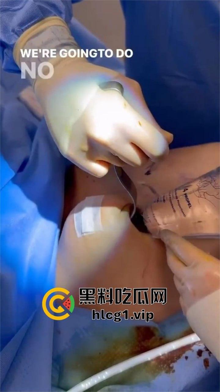 7W就能让你机场变巨乳！抖音上那些36D大胸妹子，原来都是这么来的！-17