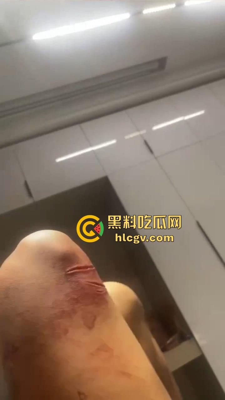 朋友圈成了血腥展示场？王湳权手刃女友后发朋友圈，画面直击心灵，血腥内容慎入！-15
