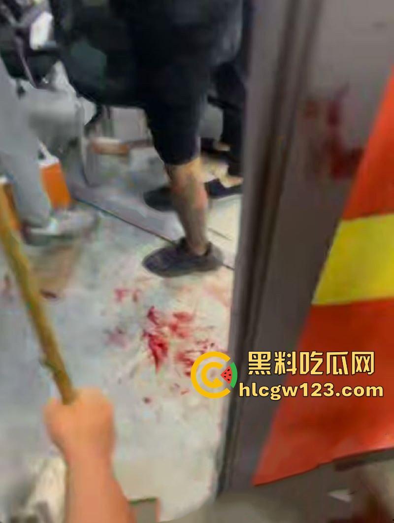 精神小伙台球厅打斗事件！暴怒持刀砍人 手掌惨遭斩成两半 现场血淋淋一片 场面极其血腥胆小勿入！-4
