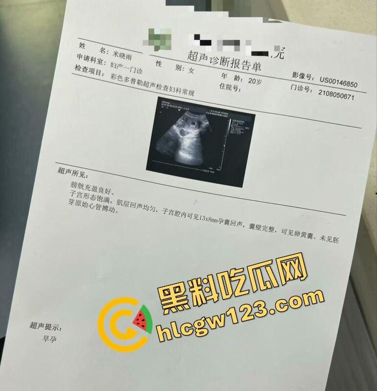 老套路玩不腻，江西老哥约小仙女无套爽完2周内直接中标！说怀孕就怀孕，喜当爹都反应不过来！-8