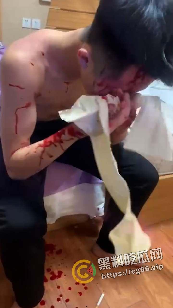 精神小伙1v3!小伙偷情兄弟女朋友 反被女人诬陷 带着闺蜜一起打 头干裂开了 现场血腥画面曝光-5