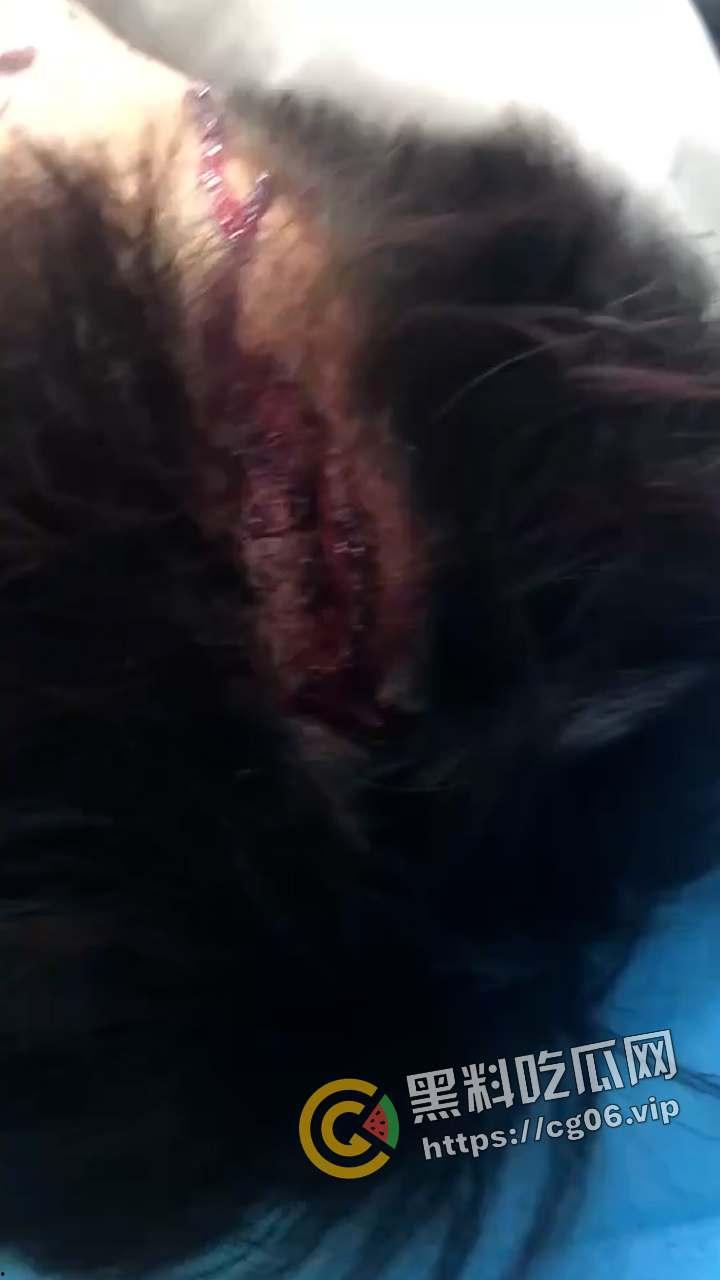 精神小伙1v3!小伙偷情兄弟女朋友 反被女人诬陷 带着闺蜜一起打 头干裂开了 现场血腥画面曝光-6
