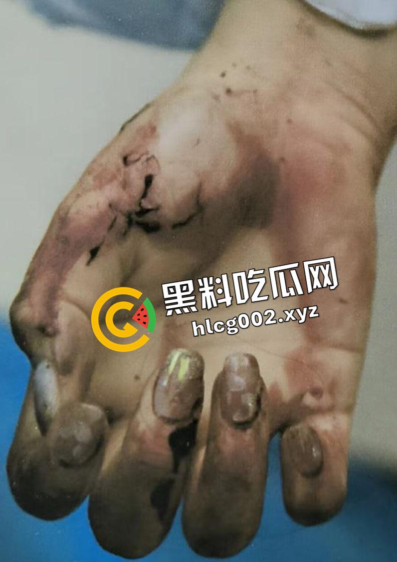 恐怖慎入!辽宁【徐园】案尸检现场视频流出 被前男友家暴致死打的面目全非-7