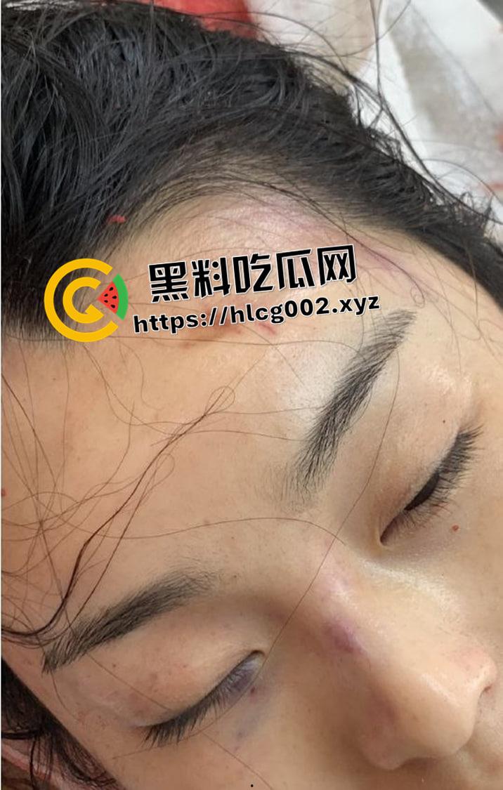 恐怖慎入!辽宁【徐园】案尸检现场视频流出 被前男友家暴致死打的面目全非-11