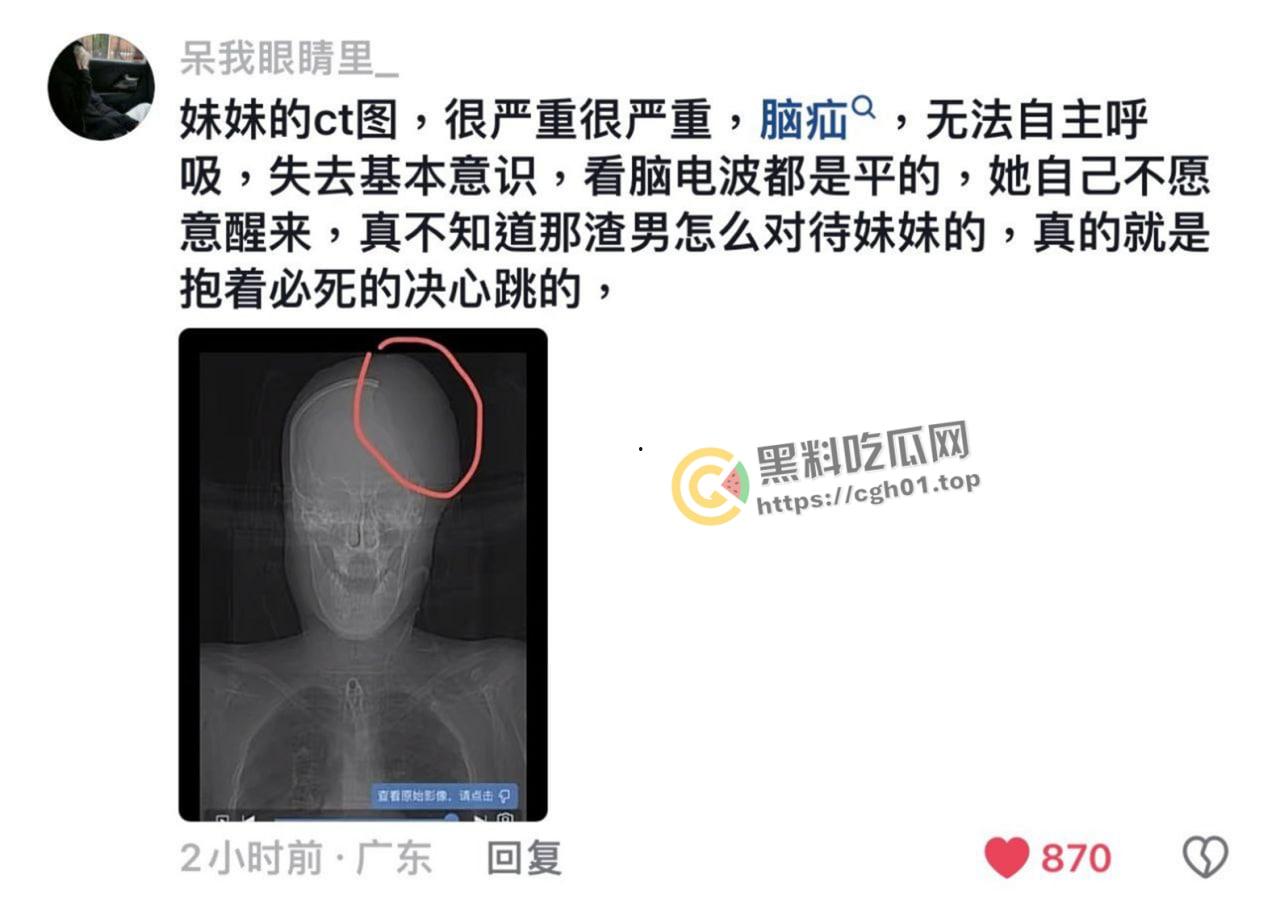 网红二次元妹妹的为爱冲锋!不爱我我就去死 跳楼自杀脑死亡 这么漂亮的妹妹 【朱志明】糊涂啊-4