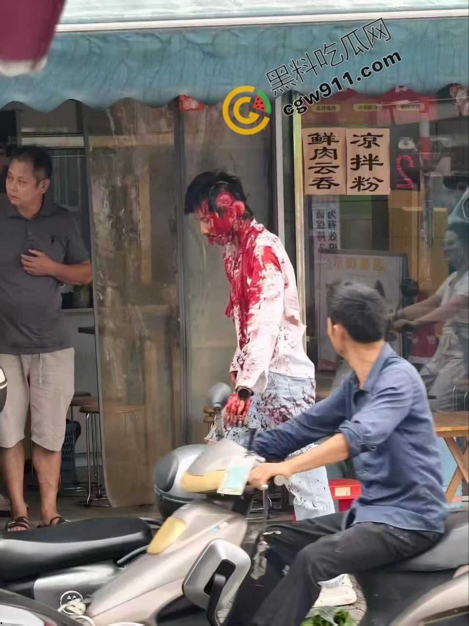 广西柳州街头疯狂砍人事件！男子疯狂持刀追砍，残暴削掉头皮，引爆全城惊恐！-6