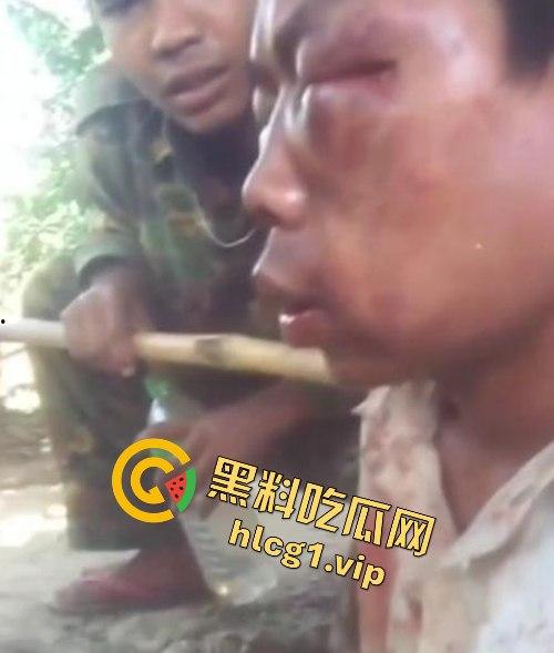 缅甸妙瓦底军阀虐待人质视频曝光，男子被殴打至面目全非，血迹斑斑的恐怖真相！-3