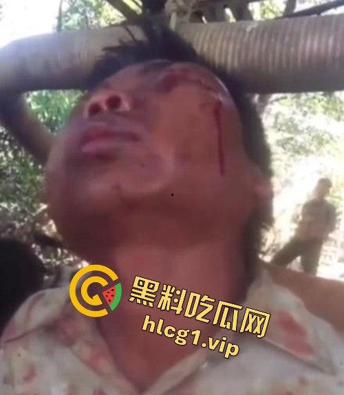 缅甸妙瓦底军阀虐待人质视频曝光，男子被殴打至面目全非，血迹斑斑的恐怖真相！-6