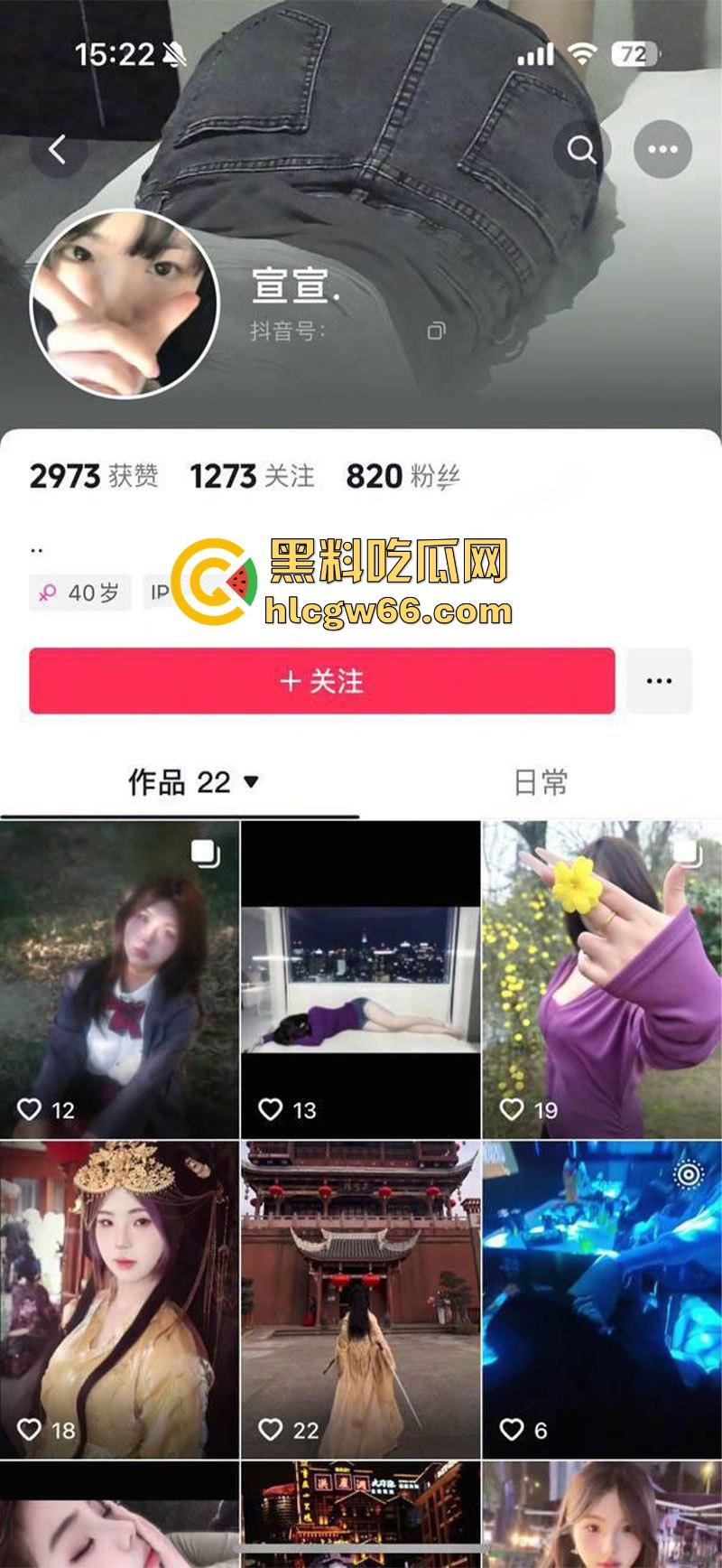 抖音天生荡妇圣体【宣宣】被网调教自慰 爆扣大黑木耳揉捏黑珍珠奶头 这逼一看就平时没少挨炮啊！-1