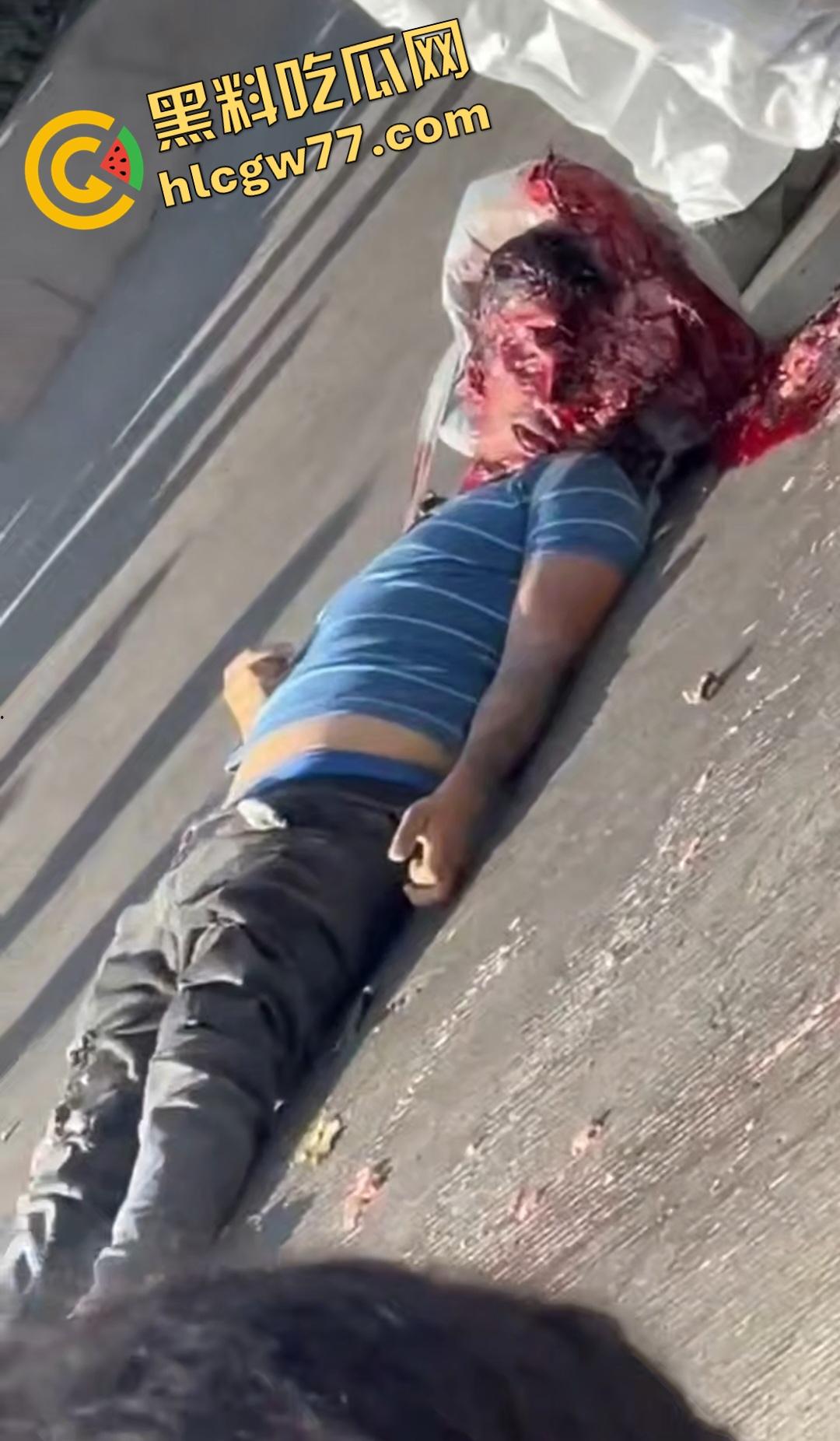 蓝色衣服男电动车车祸爆头血腥惨剧！眼珠弹出还能救？世上竟有神人？-4