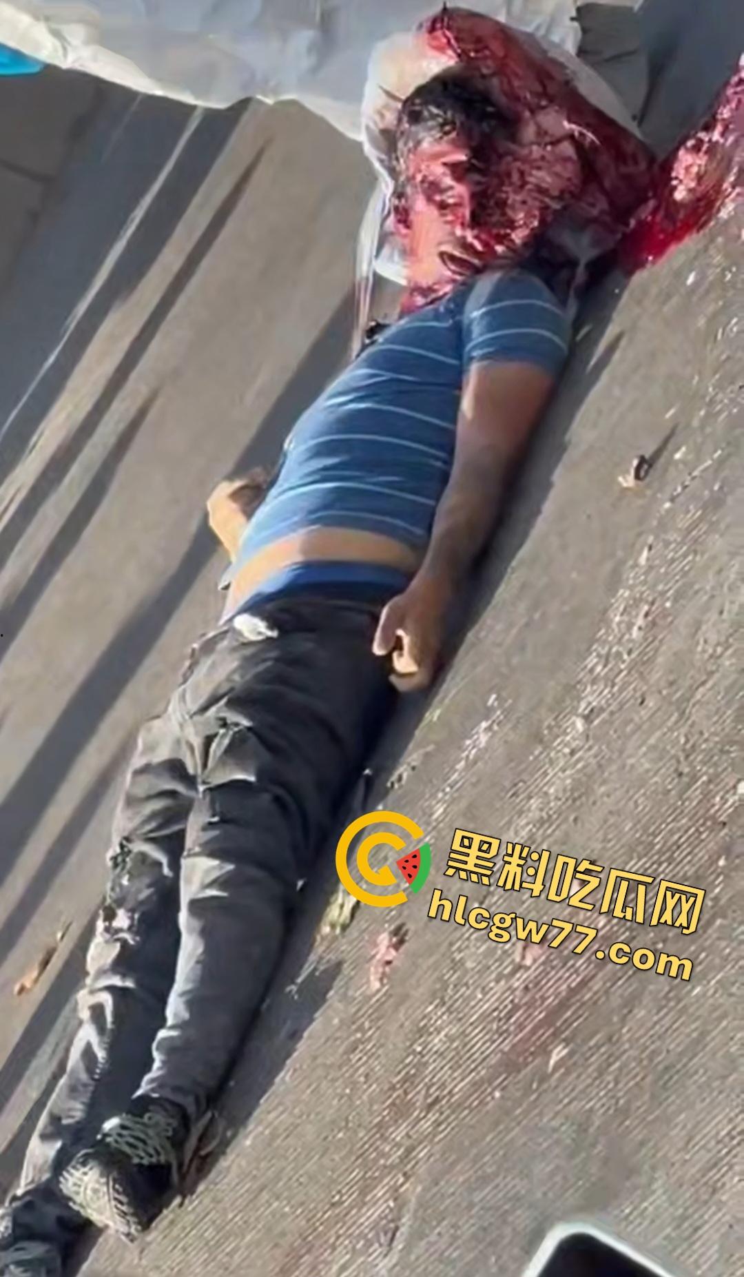 蓝色衣服男电动车车祸爆头血腥惨剧！眼珠弹出还能救？世上竟有神人？-7