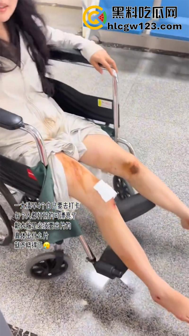 一生要强的中国女人,就算出车祸一身伤,也是必须要出片,不管摔成什么样拍照才是第一位!-5