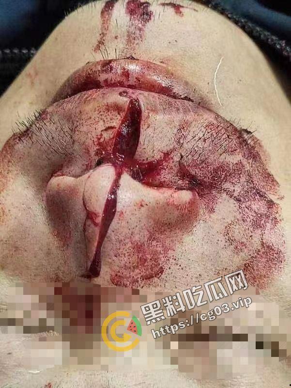 嚣张！广西容县城北路少年砍人 与警察互博 砍伤警察 拒不伏法 嚣张至极-5