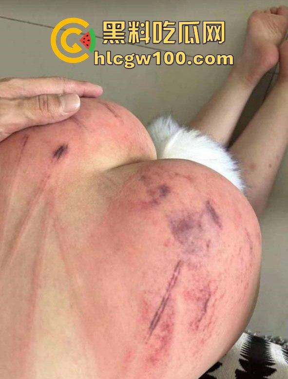 重口味推荐!山东滨州博兴三中学生妹【于翰然】金主SM调教视频流出,追求极致体验屁股都被给打烂流血了。-14