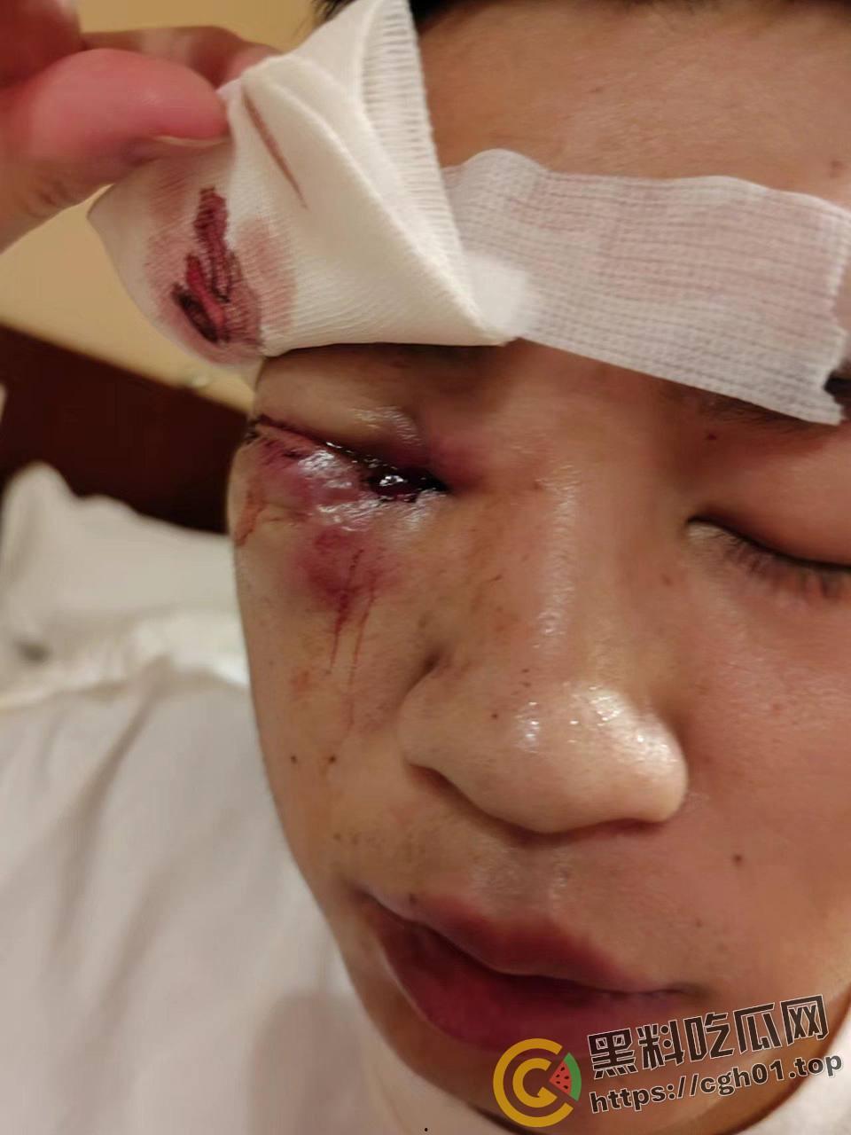 蚌埠大学生为参军做飞秒手术 在部队内遭感染被丢回家 最终不治身亡 家人抖音喊冤被封-12