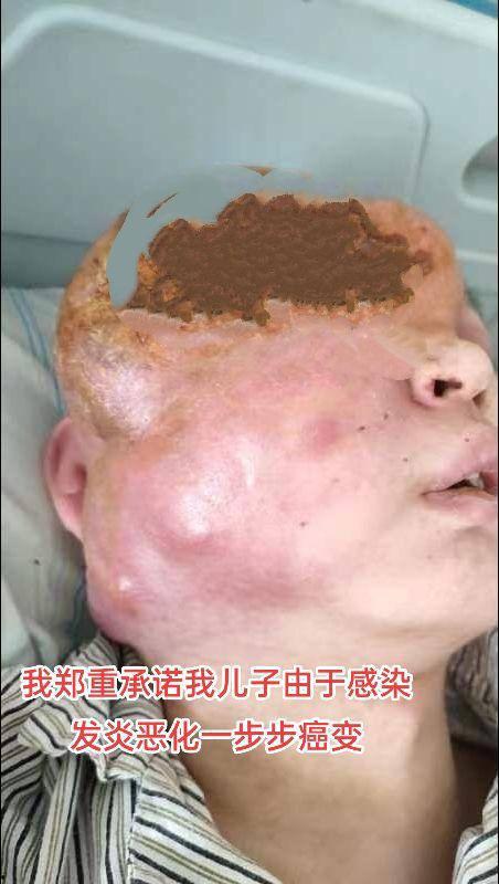 蚌埠大学生为参军做飞秒手术 在部队内遭感染被丢回家 最终不治身亡 家人抖音喊冤被封-13