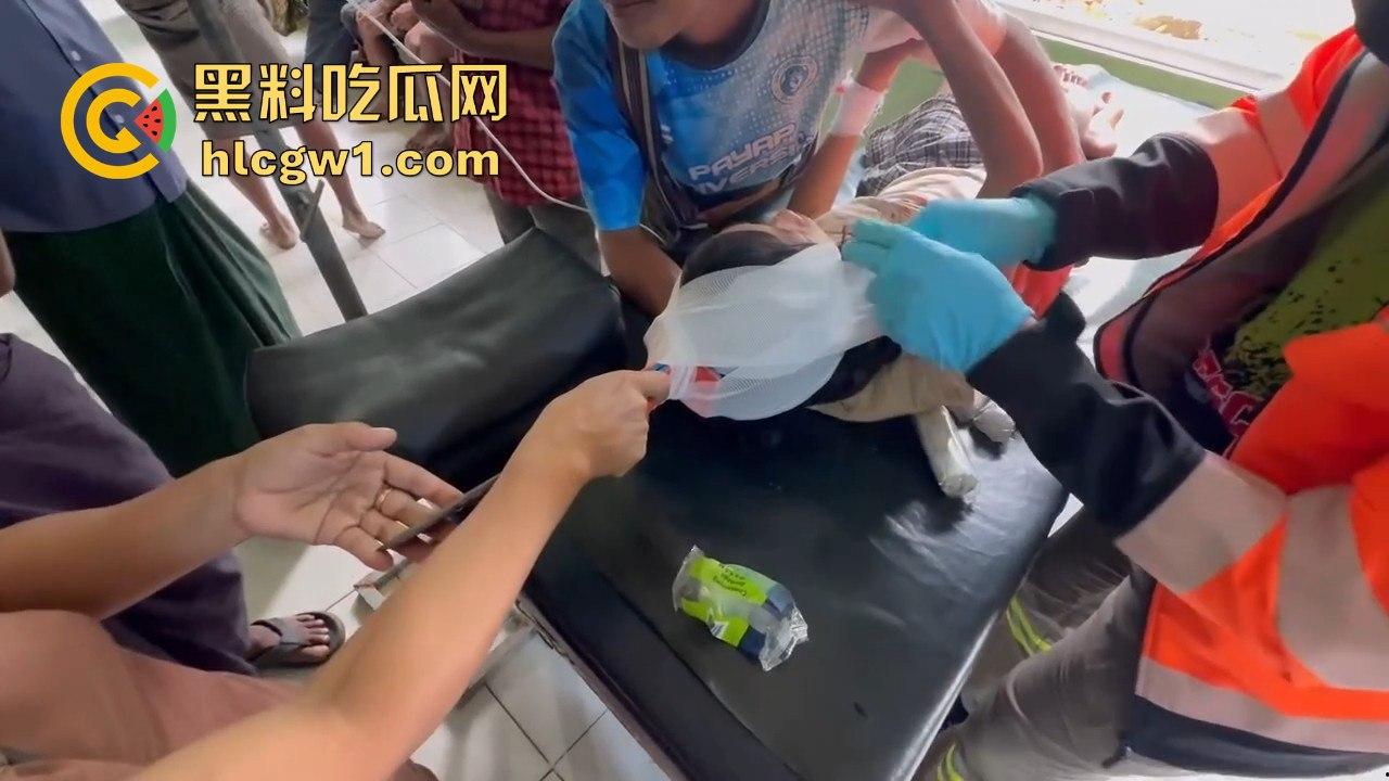 妙瓦底一女孩头部被刀插入!竹片墙掉刀酿惨剧,紧急送往泰国湄索医院!-10