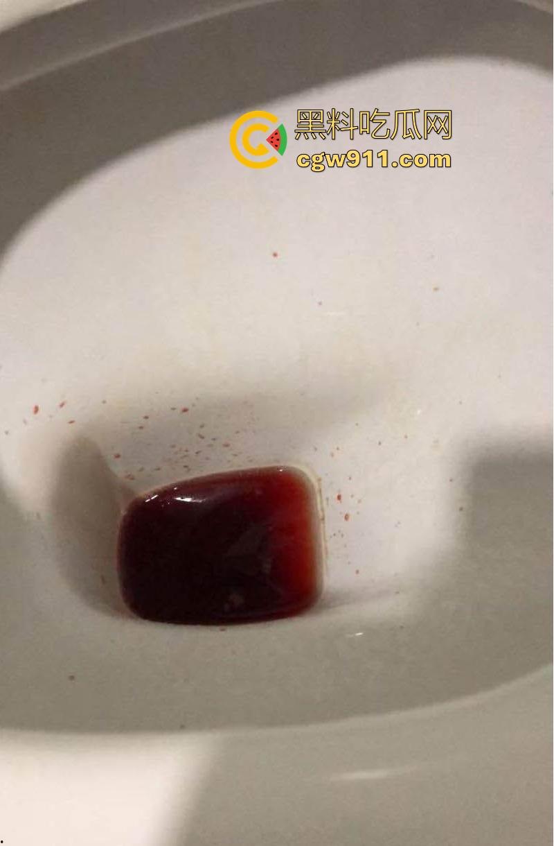 瓜友国庆节撸管翻车,撸到虚脱、心悸、血压飙升,把自己撸进ICU,聊天记录全爆疯狂自述,瓜友们要节制啊!-10