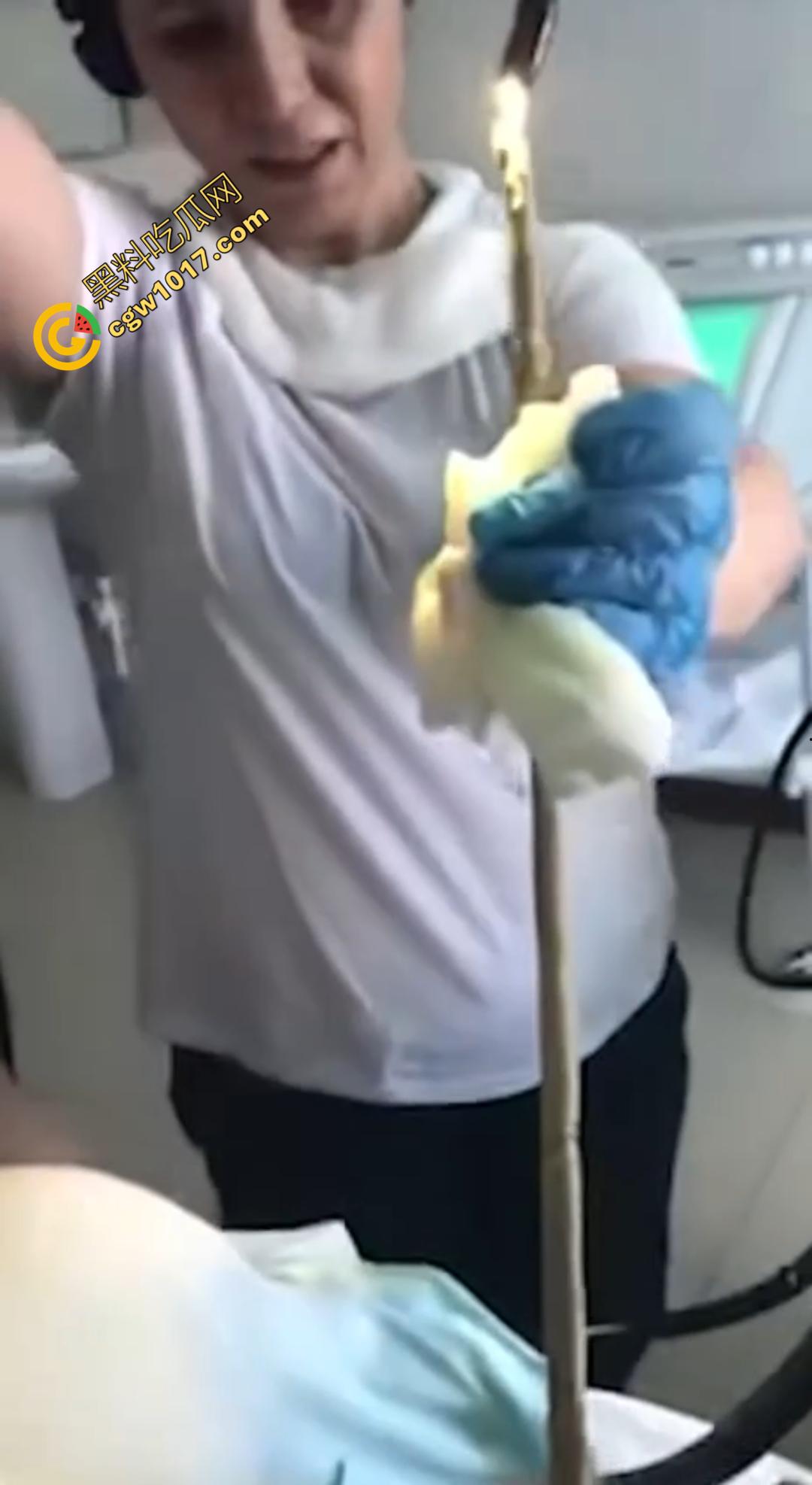俄罗斯医院活拽1米毒蛇！女患者吞蛇卵孵化钻喉，医生手抖拽出瞬间到处乱窜！-3