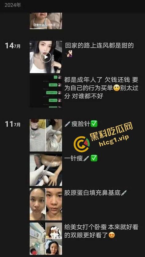 每个人体质不一样！瘦脸医美针害死人！肉毒整容 那女的 变 那女神！-9