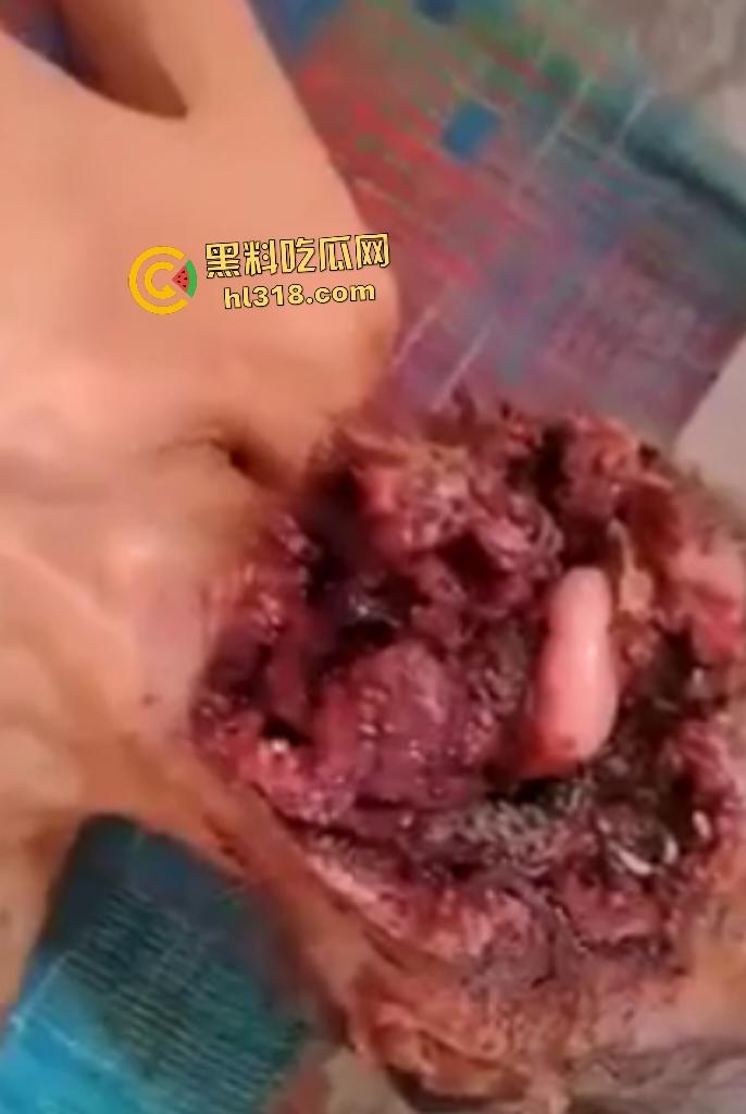 埃及老人惨遭机器重击，脸烂成浆五官全毁，只能阿巴阿巴发声音，不能说话，估计过几天就要长蛆了！-4