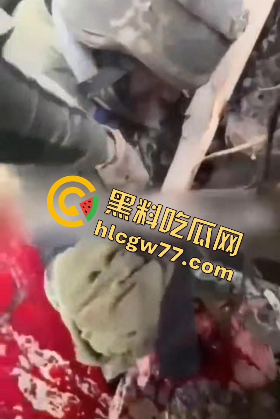 俄乌战场出现食人兵?士兵炸弹炸飞手臂骨髓喷溅,一旁队友饿了还吸食血液充饥!-4