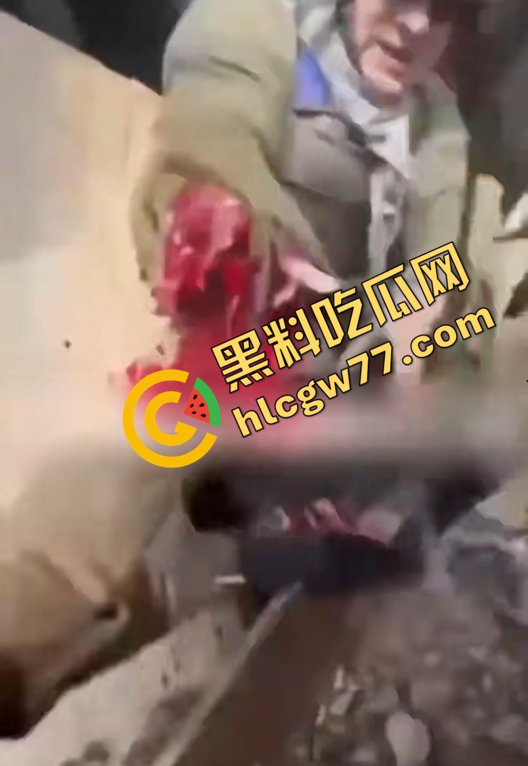 俄乌战场出现食人兵?士兵炸弹炸飞手臂骨髓喷溅,一旁队友饿了还吸食血液充饥!-8
