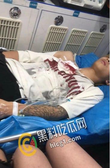 抖音热瓜 江西砍人现场！据说偷人十三四岁女刀手一人追砍两男一死一伤 后又被复仇砍伤 双双入院 太刺激了-7
