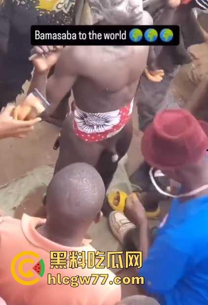 非洲部落割包皮 这也太生猛了吧 包皮一拉一刀下去直接割掉 这老哥全程面无表情!-3