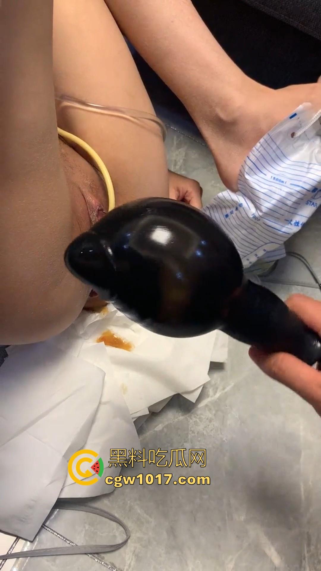 重口慎点！充气式肛塞，导尿管，玩弄穿环女奴！一开始以为平平无奇，拔出来才知道这肛门这么能塞啊！-8