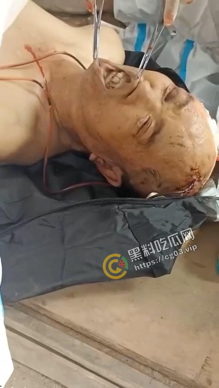 缅甸电诈 四大家族之一的【明学昌】被自杀，尸体拉到中缅边境做尸检 儿子和姑姑自首 现场画面曝光！-8