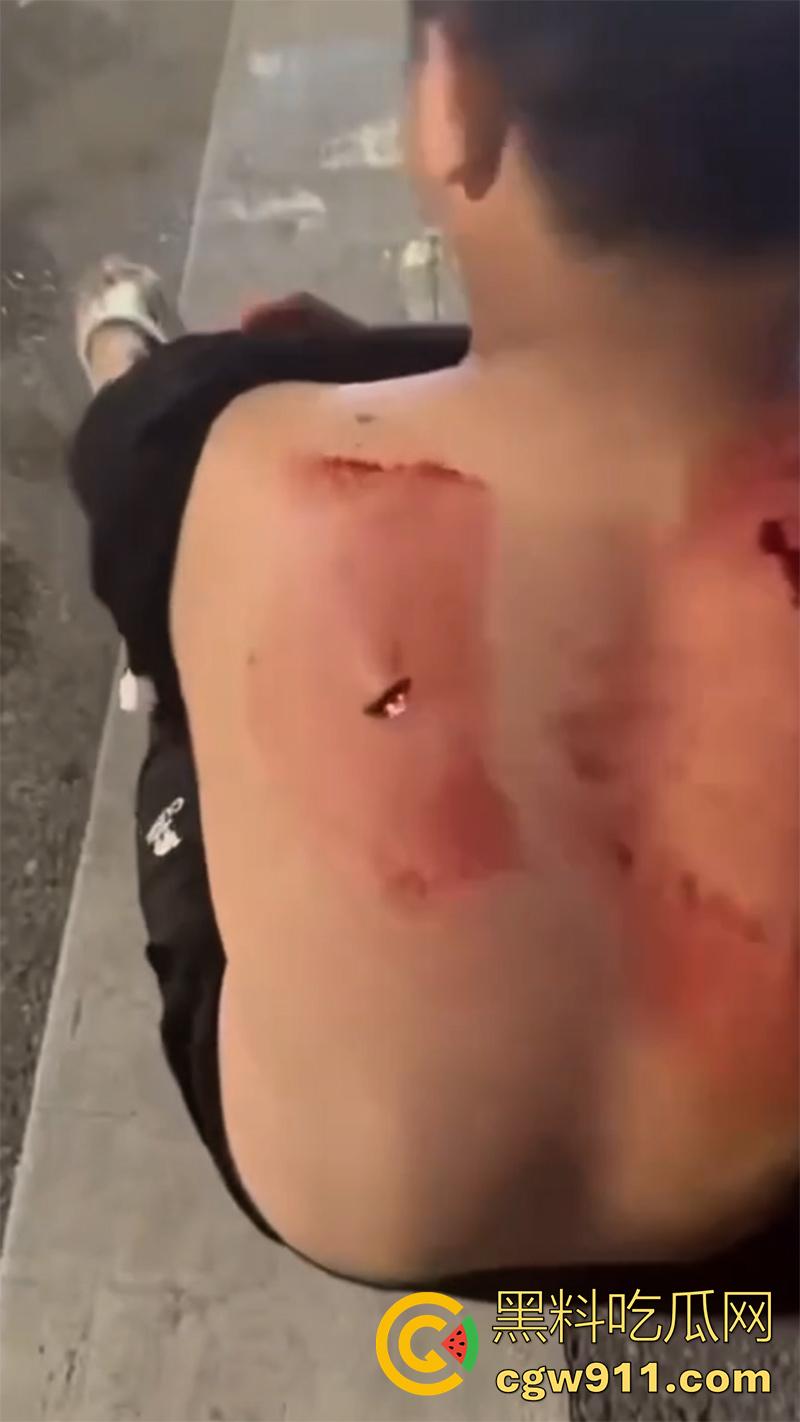 江西赣州第七中学，精神小伙小妹发生口角，叫人斗殴持砍刀砍人，警方和120急救人员陆续赶到，现场多人受伤。-4