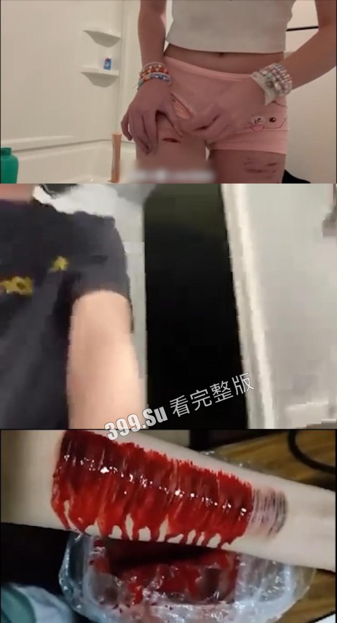 慎点！！！自残篇  身体发肤，受之父母，请爱自己（视频越往后越血腥）-4