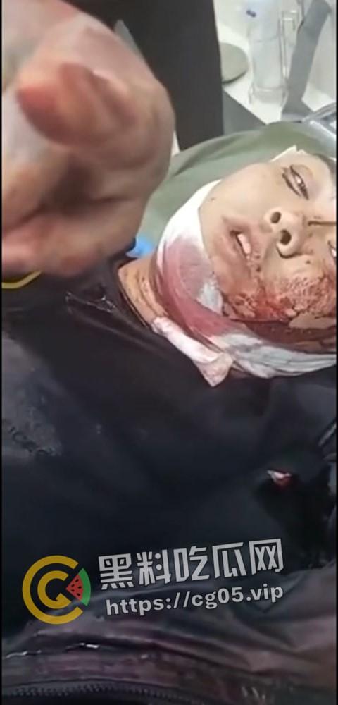 精神小伙哈尔滨斯卡拉迪厅前挑衅！上一秒嚣张至极 下一秒被打成猪头 活该-4