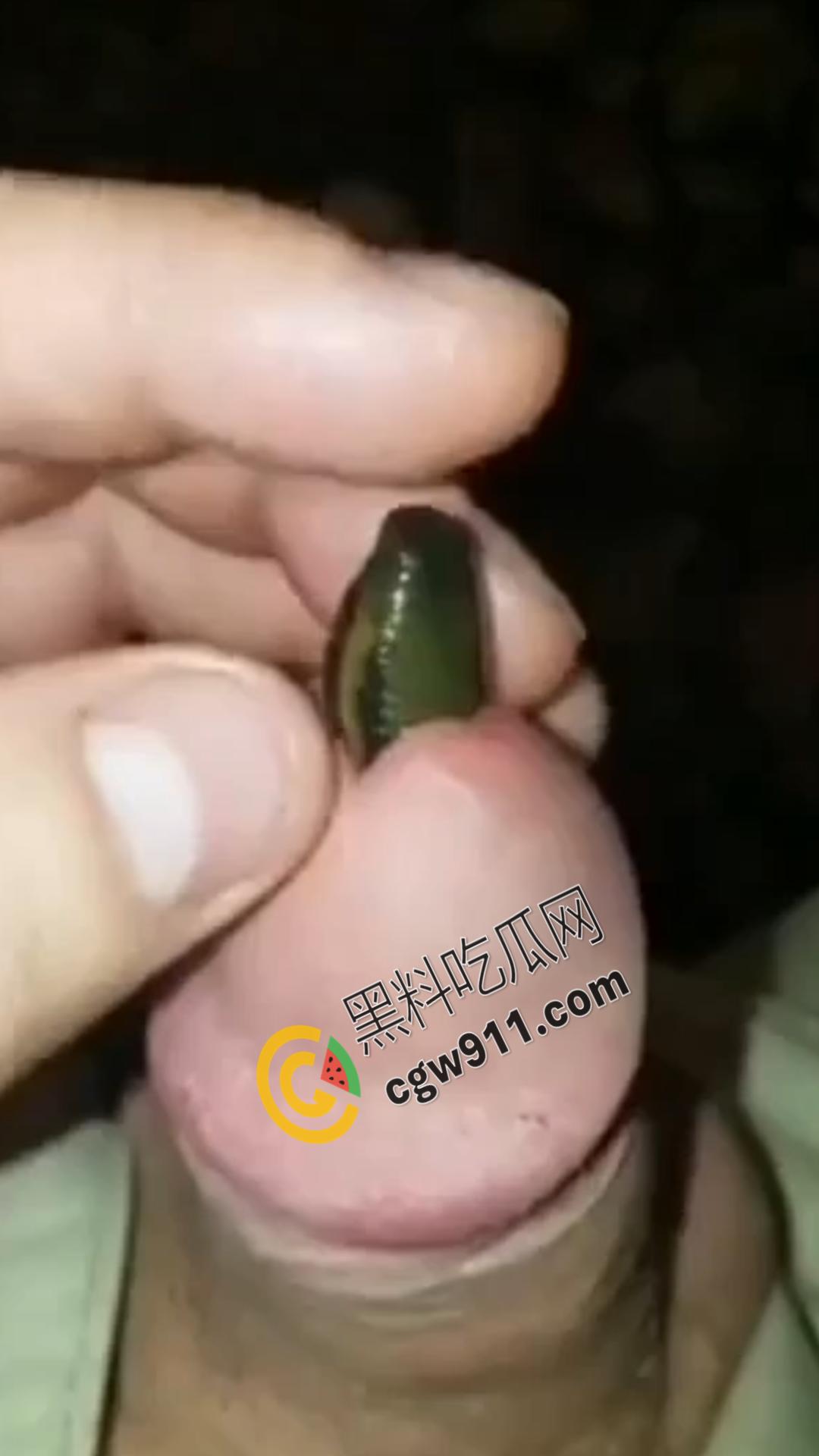 恐怖刺激！活蚂蟥钻入男子大屌的惊悚作死视频，观看者直呼恶心，视觉冲击骇人听闻-4