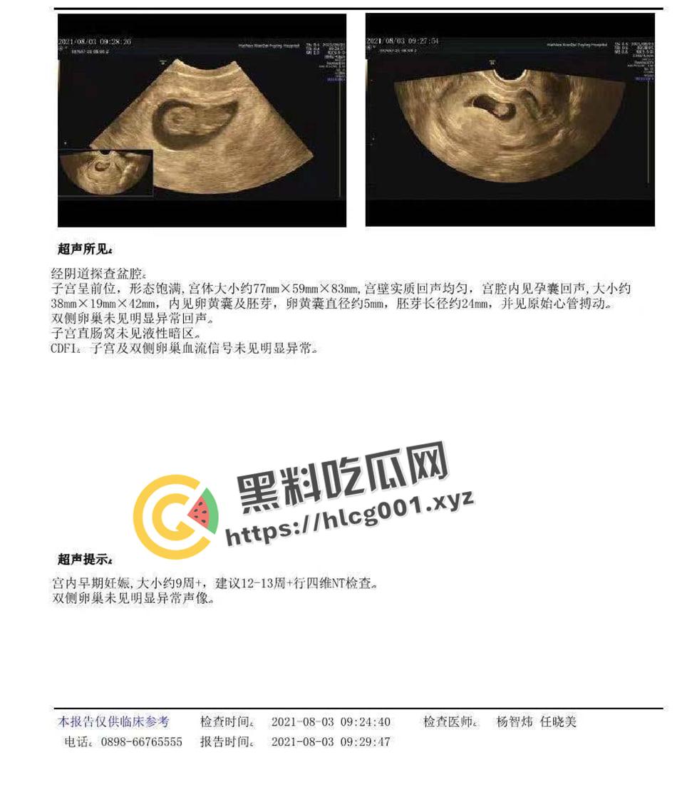 临高网红【邓良娟】手机遭破解泄密  偷吃怀孕打胎三次还骗男友钱 最后接盘侠全盘接下 私密视频流出-6