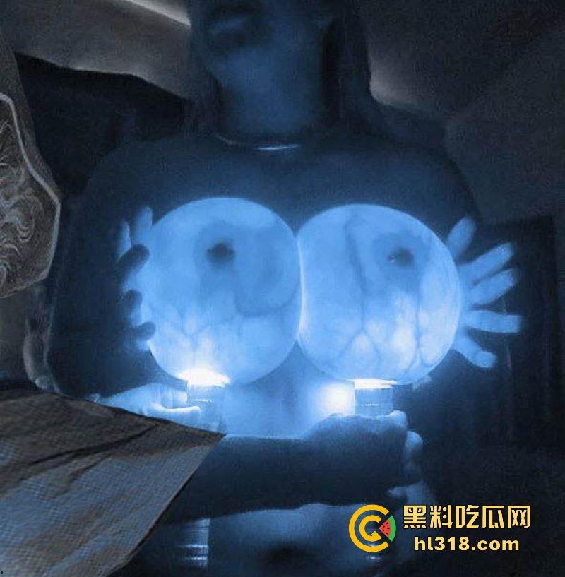 教大家如何分辨假胸，其实假胸跟灯罩一个道理，打灯上去就会完全透，宛如一个宇宙飞船！-1