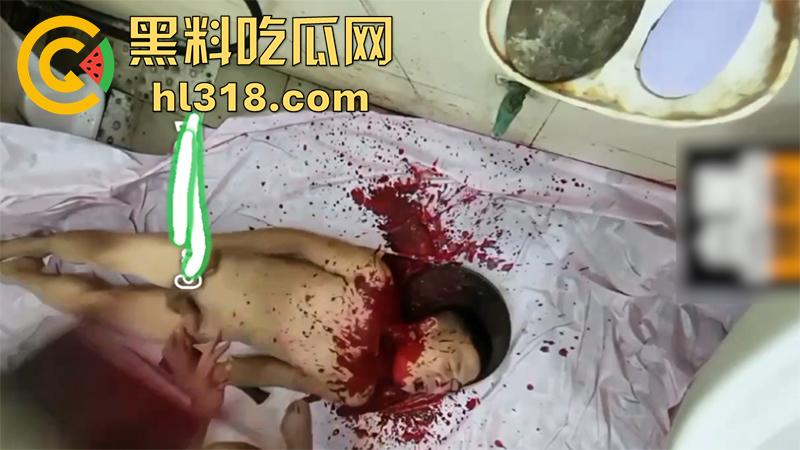 暗网恐怖性虐合集，铁钳拔乳头女尸法检，放狗啃食鸡鸡，撸管被当场剁头切割阴茎，场面血腥胆小者勿入！-2