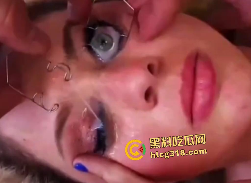 外国女子用开眼器撑眼皮，被男友撸管射精进眼睛，精子灌满双眼，这是开天眼了吧？-7